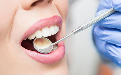 Dental Consultation & Check-up